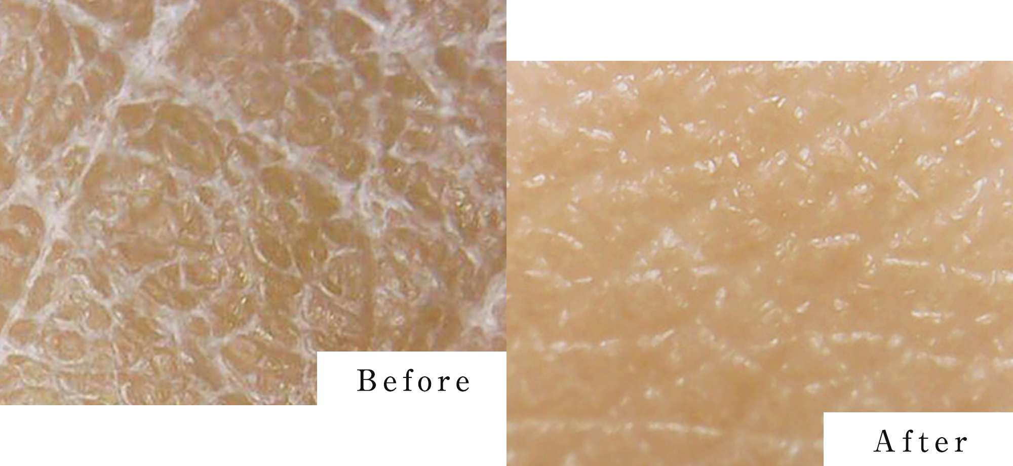 ステムボーテ　新品未開封 StemBeaute（ステムボーテ）| 次世代の人（ヒト）幹細胞培養液を